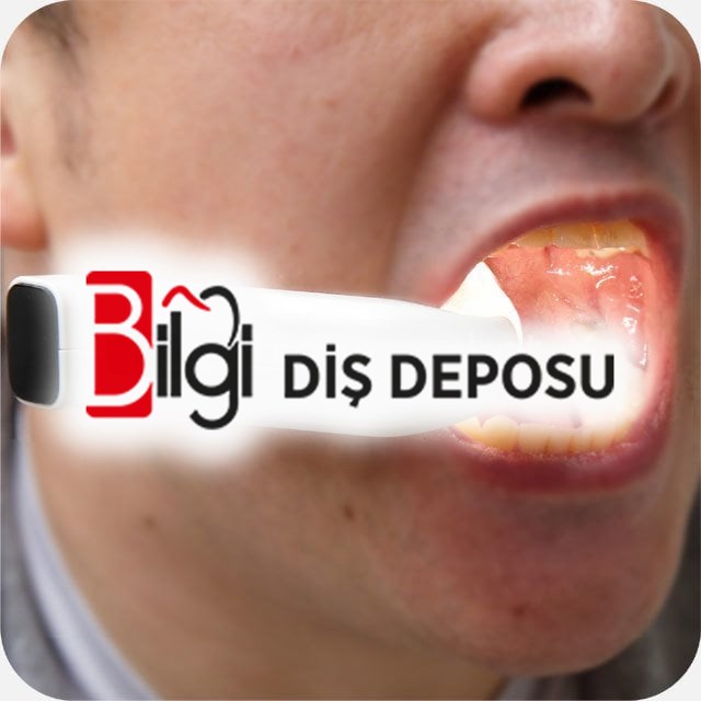 Işıklı Agız Ekartörü