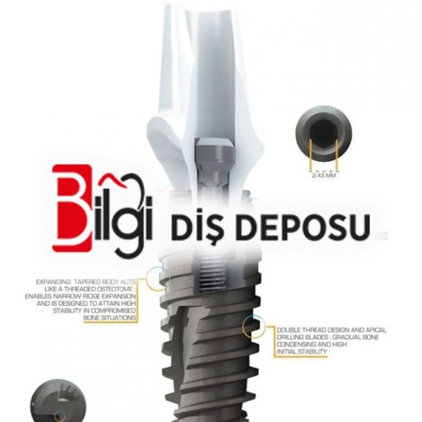 Titanyum İmplant ve Üst Yapı Dahil Çap:5 mm
