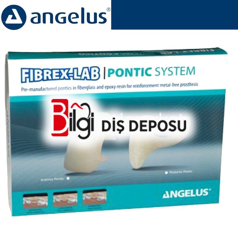 Fibrex-Lab Pontic System Kit