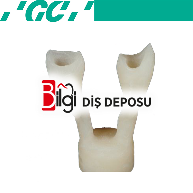 Initial Ceramics Pressable System