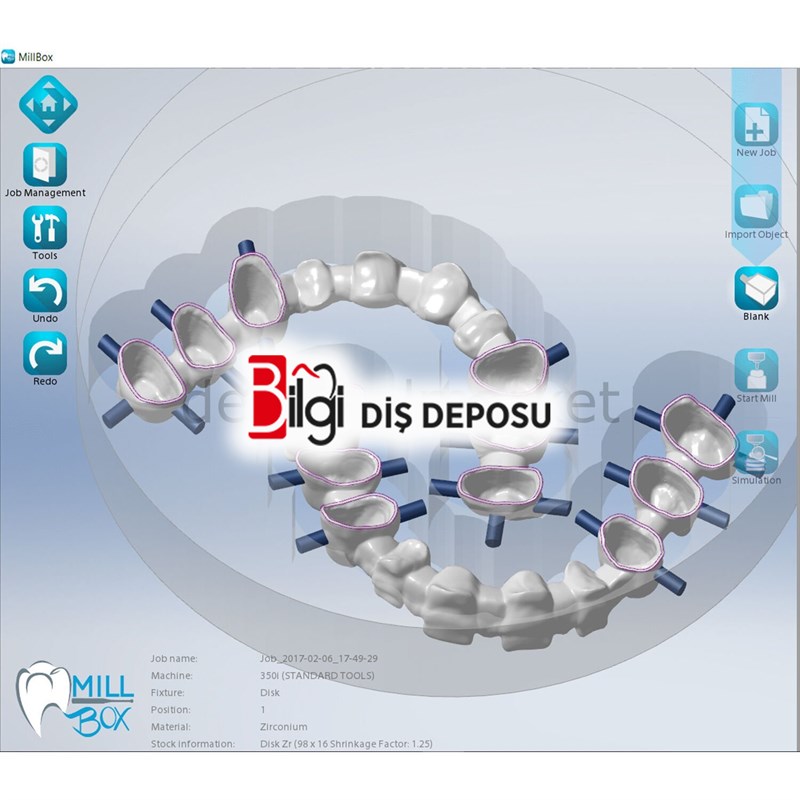Dental Kazıyıcı Makineler için Yönetim Yazılımı