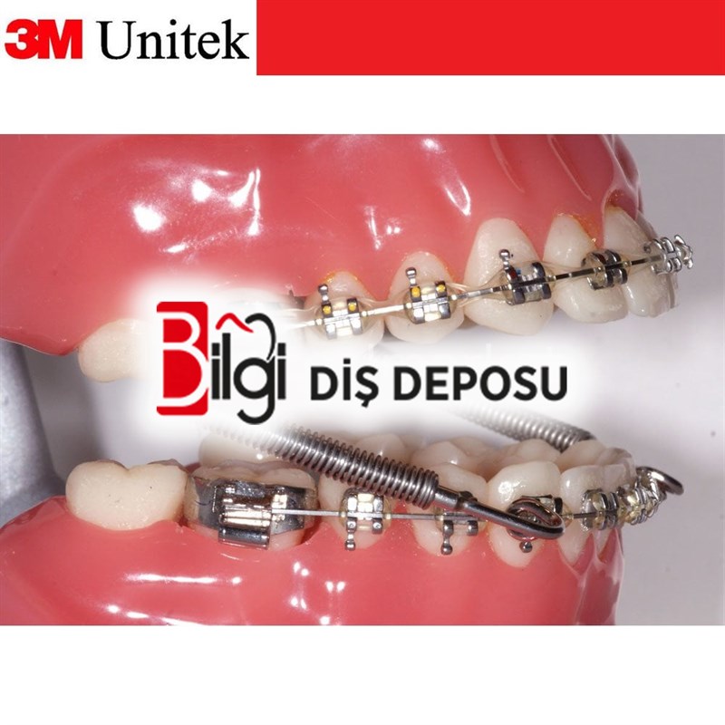 Forsus Tek Hastalık Kit
