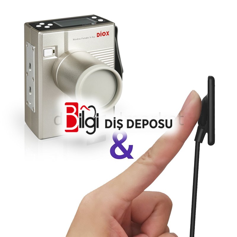 Diox Taşınabilir Röntgen ve Rvg Cihazı