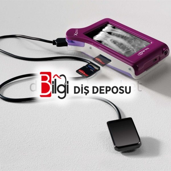X-Pod Rvg Cihazı
